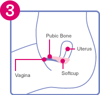 32 How To Insert A Tampon Diagram - Wiring Diagram List